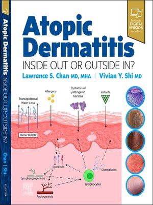 cover image of Atopic Dermatitis